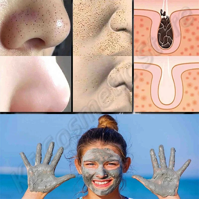 Yocity Volcanic Mud Mask Deep Pore Cleansing Treatment