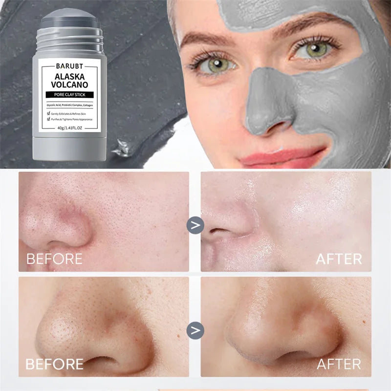 Yocity Volcanic Mud Mask Deep Pore Cleansing Treatment