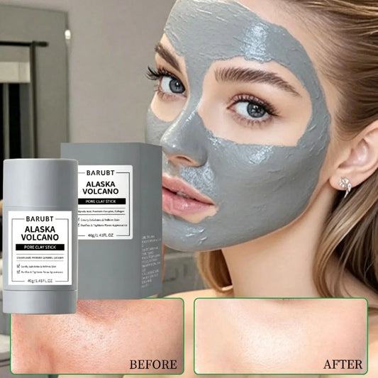 Yocity Volcanic Mud Mask Deep Pore Cleansing Treatment